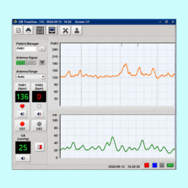 Portable Fetal Monitor