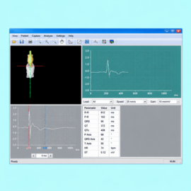 Portable Spirometry System