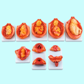 The Development Process For Fetus
